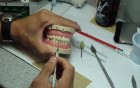 Anterior Bridge Preparation, Part 12 - Jet Provisional Polished