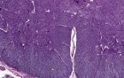 Spinal Cord - Histology