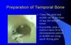 Learning Tool For Tympanic Membrane Surgeries