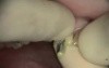 How to get a perfect smile in one visit?