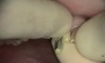 How to get a perfect smile in one visit?