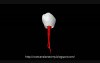Taurodontism: Mandibular First Premolar