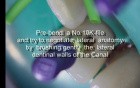Lateral anatomy management