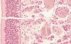 Nasal Cavity - Histology