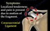 Os Acromiale Treatment 