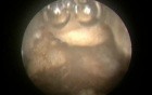 Greenlight HPS - Fat