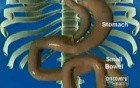 Mini Gastric Bypass Animation