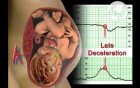 The Fetal Brain-Fetal Heart Relationship