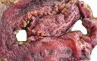 Multiple Rectal Ulcers (99 of 110)