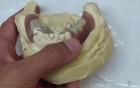 Removable Denture Clasp Repair Part 3 - Denture On Cast