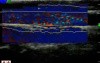 Motion Analysis 