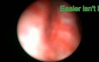 Ureteroscopy - Part 1