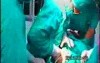 Caesarean
