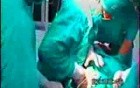 Caesarean