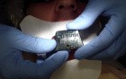 Mouth Prop/Bite Block