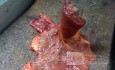 Ascending Colon Intussusception due to a Adenocarcinoma (2 of 6)