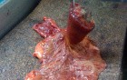 Ascending Colon Intussusception due to a Adenocarcinoma (2 of 6)