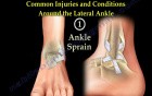 Anatomy And Injuries Of The Lateral Ankle 