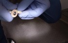 Chairside Porcelain Crown Polishing
