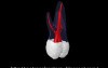 Maxillary First Molar