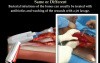 Termites & Bacteria Infection - Video Lecture