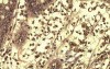 High power view of brown pigment inside of macrophages
 at the lamina propria
