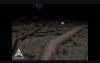 Frozen Shoulder - 3D Medical Animation