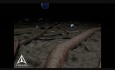 Frozen Shoulder - 3D Medical Animation