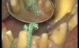 Finishing Preparations - Prosthetic Rehabilitation (1/3)