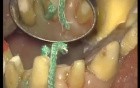 Finishing Preparations - Prosthetic Rehabilitation (1/3)