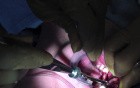 Bone Graft - Ramus Incisions