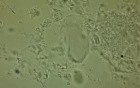 Postcoital Test (PCT) - In Vivo - 3h
