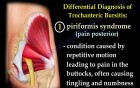 Trochanteric Bursitis - Description and Treatment