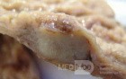 Adenocarcinoma of the Antrum and incisura angularis (9 of 12)