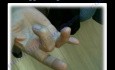 Classic Trigger Finger - Case