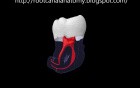 Mandibular Third Molar - Root Canal Anatomy