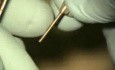 Perioscope Presentation