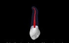 Maxillary Canine - Root Canal Anatomy