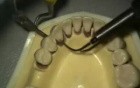 Ultrasonic Endoscopic  Debridement Simulation (LL, LA)