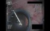 Cataract Surgery XI - Part 1