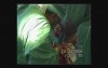 Cardioesophageal Cancer Surgery