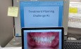 Treatment Planning Challenge #1