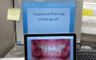 Treatment Planning Challenge #1
