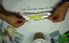 Extraoral Dressing Over Sutures