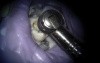 Maxillary Molar Endo Access - Table Top Microscope
