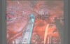 Uniportal VATS Middle Lobectomy Lung Cancer