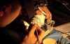 Diagnostic Waxup Part 13
