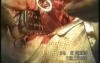 Lobectomy - Lung Cancer Surgery
