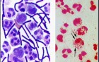 Infectious Diseases - MSP - 8e