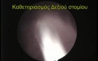 Retrograde Fluoroscopic Study